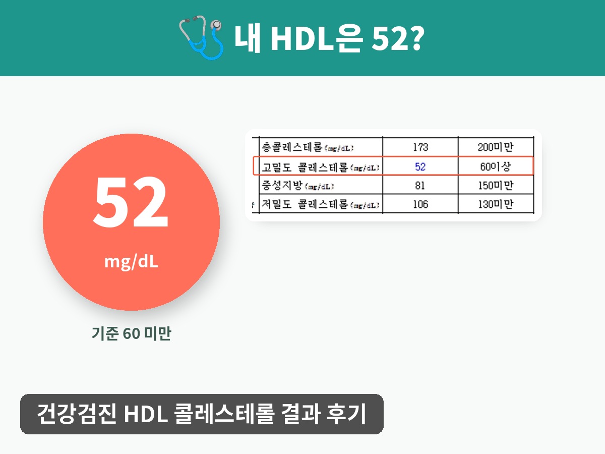 건강검진 HDL 콜레스테롤 52mg/dL 검사 결과